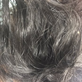 Picture Of Lice Nits 2of3 Yelp