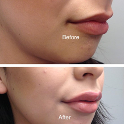 Coastal Valley Dermatology - Roya Javid MD, MHS