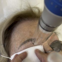 EradiTatt Tattoo Removal of St. Petersburg