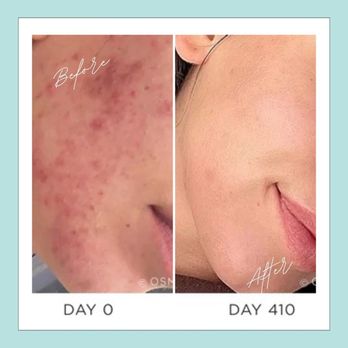 MK Skin Studio - Skin Care Near Me - Studio City, California MK Skin Studio - Skin Care Near Me - Studio City, California