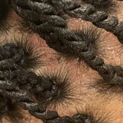 Binta Africa Hair Braiding - More bumps because of the tightness