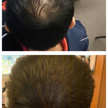 Blowology Dry Bar & Spa Sf - Hair Loss Centers Near Me Blowology Dry Bar & Spa Sf - Hair Loss Centers Near Me