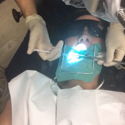 Fort Bend Endodontic Specialists - During the procedure...hardest part was keeping my mouth open.