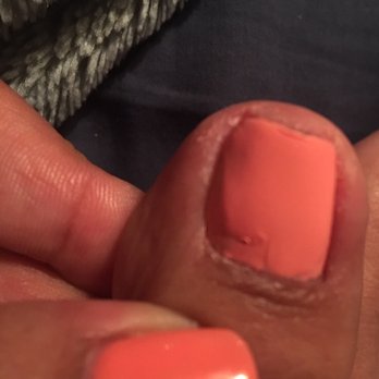 Ty & Lynn Salon - Toe nail lady fixed - Hair Salons Near Me - Redondo Beach, California Ty & Lynn Salon - Toe nail lady fixed - Hair Salons Near Me - Redondo Beach, California