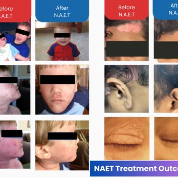 The NAET Clinic - Naturopathic/Holistic Near Me - Whittier, California The NAET Clinic - Naturopathic/Holistic Near Me - Whittier, California