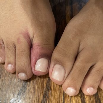 Arya Nail Lounge - Big toe on the right (left foot) has no shine. Second toe is poorly done and the other toes are carelessly painted. - Nail Salons Near Me - Branchburg, New Jersey Arya Nail Lounge - Big toe on the right (left foot) has no shine. Second toe is poorly done and the other toes are carelessly painted. - Nail Salons Near Me - Branchburg, New Jersey