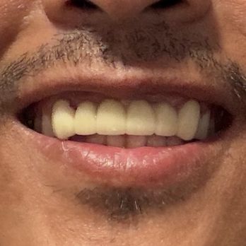 Cedar Smiles Dentistry - the old one - General Dentistry Near Me - Bellflower, California