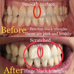 Hamilton Mountain Dental Group - Unprofessional! Unsafe! Money first! Violent and inhuman hygienist Lisa!