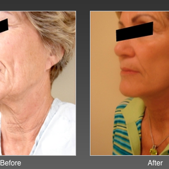 Kimberly Henry, MD Plastic Surgery - Cosmetic Surgeons Near Me - Davis, California Kimberly Henry, MD Plastic Surgery - Cosmetic Surgeons Near Me - Davis, California