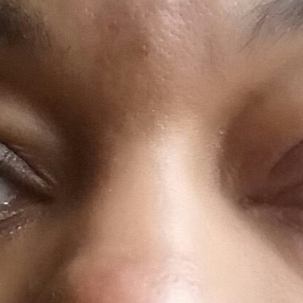 Amazing Lash Studio - Hours after my lashes were installed, my eyes were red, itchy and swollen. - Eyelash Service Near Me - Orland Park, Illinois Amazing Lash Studio - Hours after my lashes were installed, my eyes were red, itchy and swollen. - Eyelash Service Near Me - Orland Park, Illinois