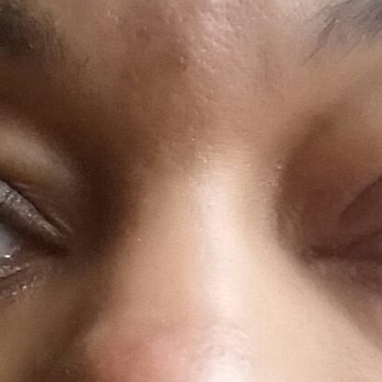 Amazing Lash Studio - Hours after my lashes were installed, my eyes were red, itchy and swollen. - Eyelash Service Near Me - Orland Park, Illinois Amazing Lash Studio - Hours after my lashes were installed, my eyes were red, itchy and swollen. - Eyelash Service Near Me - Orland Park, Illinois
