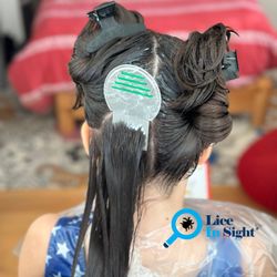 Lice In Sight