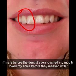 Central Valley Dentistry - Before they even touched my smile
