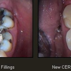 Cary N. Goldstein, DDS