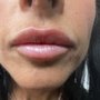 Photo of True Beauty Medspa