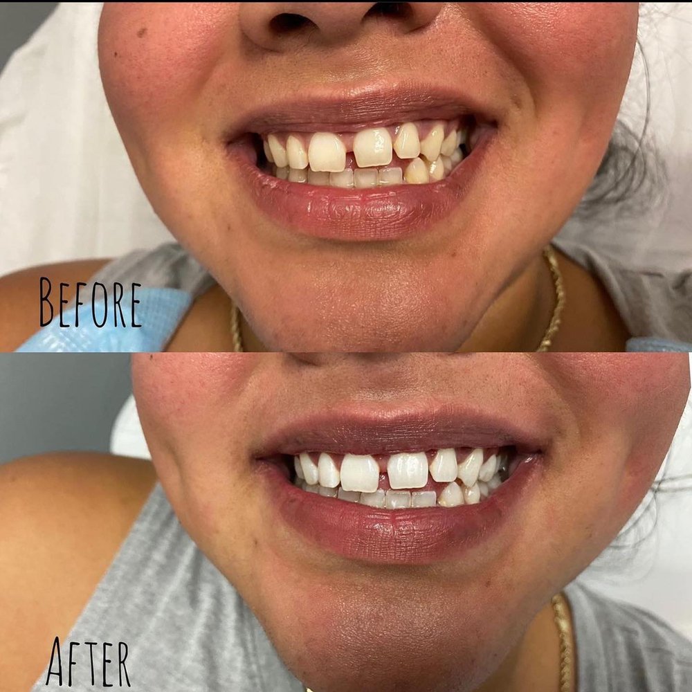 BLINK HOUSTON Updated October 2024 80 Photos 10333 Harwin Dr