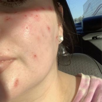 Babette Beautee - She seriously had the audacity to say that this wasn't an allergic reaction? - Eyebrow Services Near Me - Tempe, Arizona