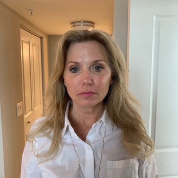 Willie Richardson, MD - my face 1 hour after procedure - Dermatologists Near Me - Fort Lauderdale, Florida Willie Richardson, MD - my face 1 hour after procedure - Dermatologists Near Me - Fort Lauderdale, Florida