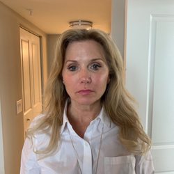 My face 1 hour after procedure