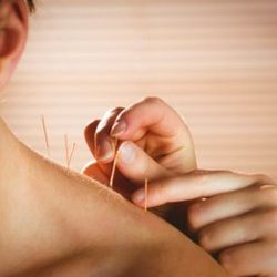 Michigan Acupuncture Studio