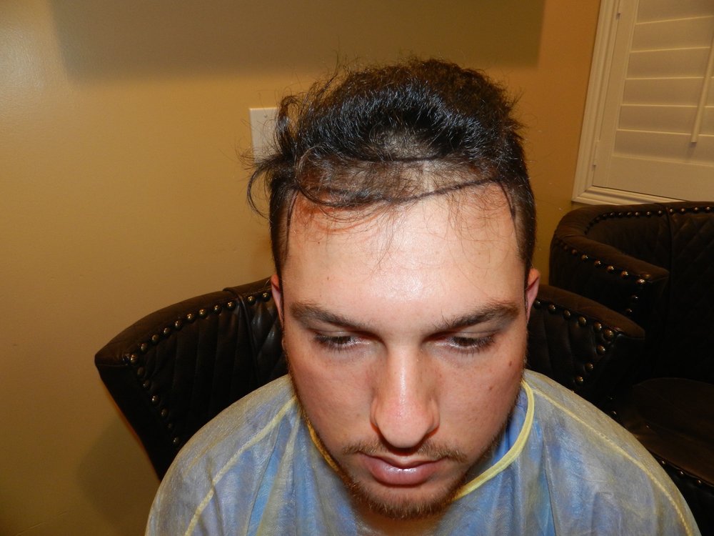 MEDICAL HAIR TRANSPLANT AND AESTHETICS 181 Photos & 69 Reviews