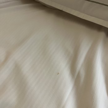 Hilton Santa Clara - Stains in bed - Hotels Near Me - Santa Clara, California