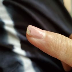 City Nails & Spa - Vertical tear. the nail tech wouldn't put a little gel on the nail to prevent more tearing.