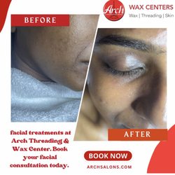 Arch Threading & Wax Center - After and before facial treatments