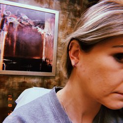 Dermatology Realm - Ear Lobe Repair