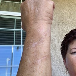 Eric L. Giang, D.O - The healed arm  ! Thanks doctor Giang