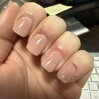 Polish Nails Spa - Sore cuticles - Nail Salons Near Me - Santee, California Polish Nails Spa - Sore cuticles - Nail Salons Near Me - Santee, California