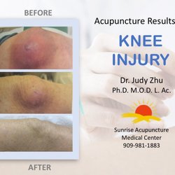 Sunrise Acupuncture Medical Center