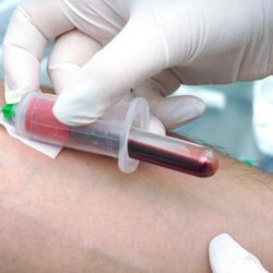 Paramex Screening Services - Lab work and Mobile Phlebotomy