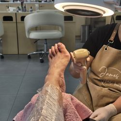 Callus remover