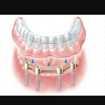 Sun City Dental - We offer these services with over 15 yrs experience - Cosmetic Dentists Near Me - Toronto, Ontario Sun City Dental - We offer these services with over 15 yrs experience - Cosmetic Dentists Near Me - Toronto, Ontario