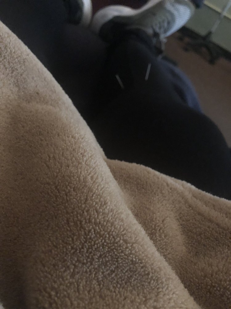 COMMUNITY ACUPUNCTURE 12 Photos & 23 Reviews 2006 S 39th St, Saint