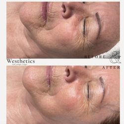 Westhetics