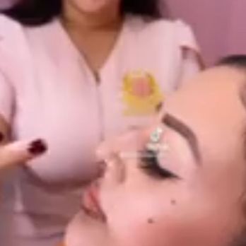 SKYN MD - Liquid rhinoplasty - Medical Spas Near Me - Ontario, California SKYN MD - Liquid rhinoplasty - Medical Spas Near Me - Ontario, California
