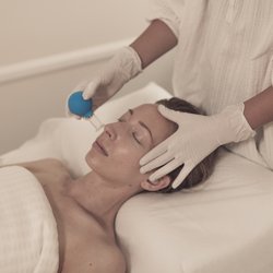Facial Cupping