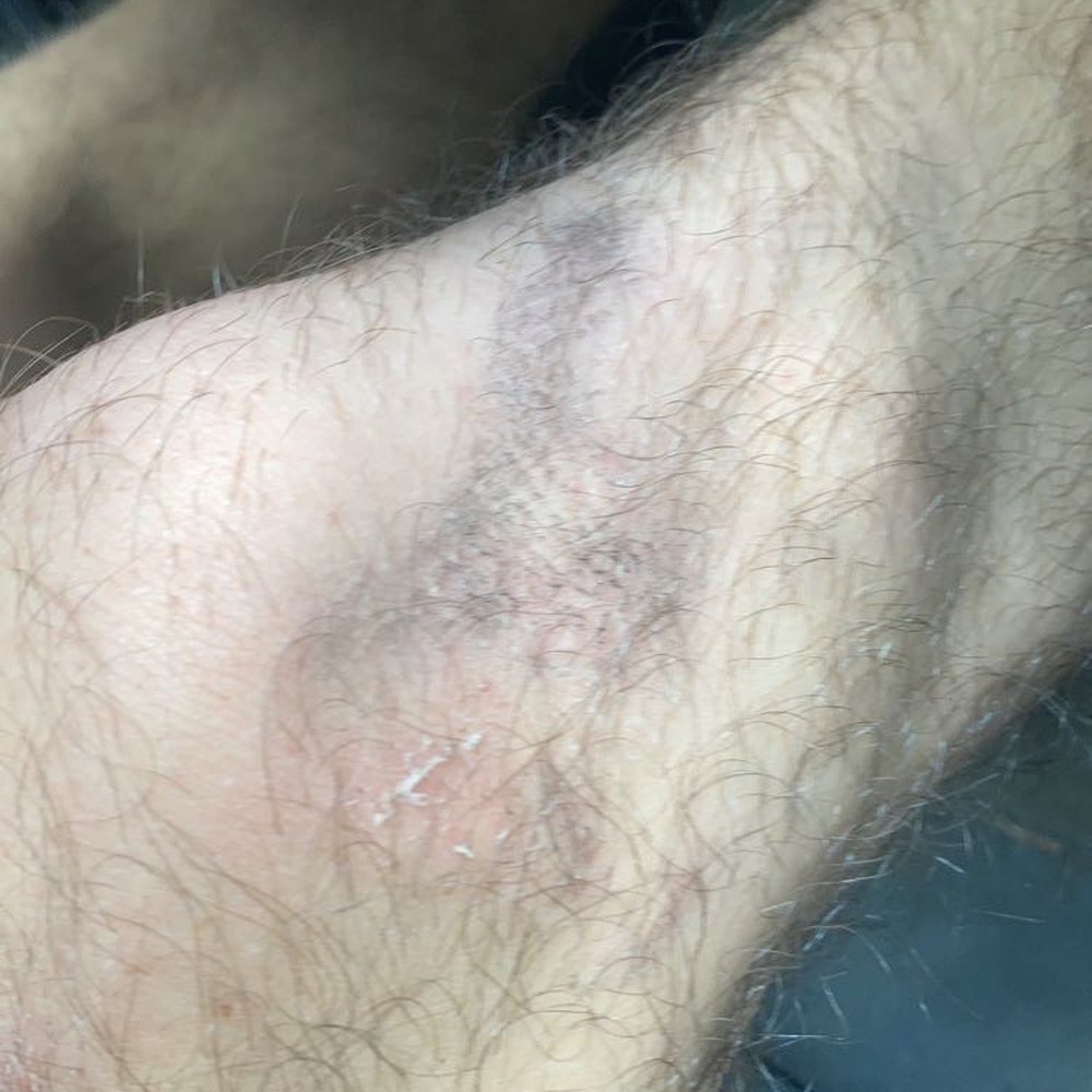 K1 Speed Orlando - Picture of his leg - Venues & Event Spaces Near Me - Orlando, Florida K1 Speed Orlando - Picture of his leg - Venues & Event Spaces Near Me - Orlando, Florida