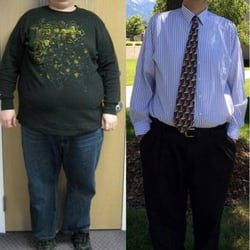 Rocky Mountain Associated Physicians - The left is me before surgery at 425 lbs. The right is me 4 years after Duodenal Switch surgery with Dr. SImper at 240 lbs.