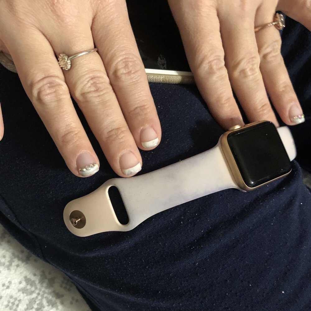 Windsor - Apple Watch and nails that were dyed trying to get these unknown chemicals off. BUT WINDSOR KNOWS THEIR CHEMICALS ARE LINKED TO CANCER. - Accessories Near Me - Appleton, Wisconsin Windsor - Apple Watch and nails that were dyed trying to get these unknown chemicals off. BUT WINDSOR KNOWS THEIR CHEMICALS ARE LINKED TO CANCER. - Accessories Near Me - Appleton, Wisconsin