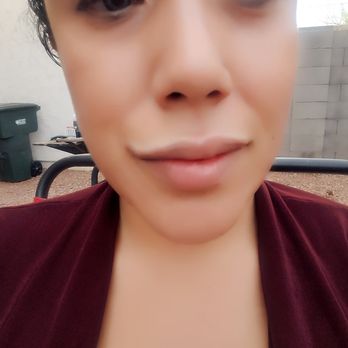 Suddenly Slimmer Med Spa - Finally have the pout I always wanted!!! - Laser Hair Removal Near Me - Phoenix, Arizona Suddenly Slimmer Med Spa - Finally have the pout I always wanted!!! - Laser Hair Removal Near Me - Phoenix, Arizona