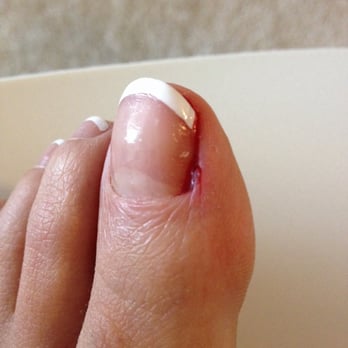 Dublin Nails - The 1st day got cut - Nail Salons Near Me - Dublin, California Dublin Nails - The 1st day got cut - Nail Salons Near Me - Dublin, California
