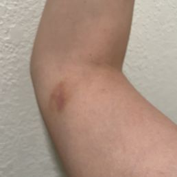 Day 8 Day 8