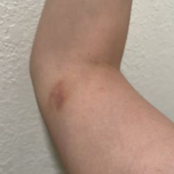 Quest Diagnostics - Day 8