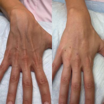 DermaPrecision - Medical Spas Near Me - Scottsdale, Arizona DermaPrecision - Medical Spas Near Me - Scottsdale, Arizona