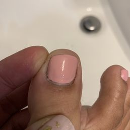 Uneven polish. And didn't even completely cover my toe in clear polish!! The very tip and near the base. Uneven polish. And didn't even completely cover my toe in clear polish!! The very tip and near the base.