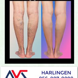 Advanced Vascular Solutions