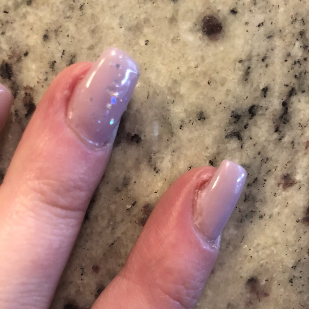 Sun Nails - Wound from manicure, this is five days later and it's still swollen and painful. - Nail Salons Near Me - San Diego, California Sun Nails - Wound from manicure, this is five days later and it's still swollen and painful. - Nail Salons Near Me - San Diego, California